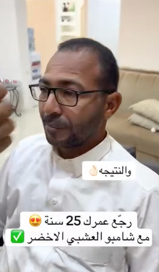 رجل بعد استخدام بابل موس — الشيب مغطّى بلون طبيعي